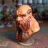 Dwarf Bust [Pre-Supported] print image